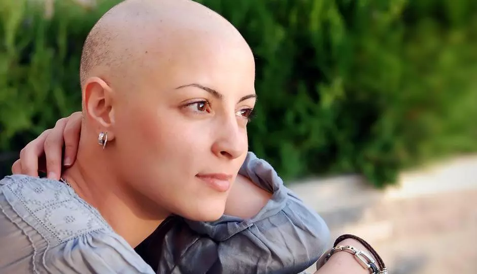 Chemotherapy And Hair Loss Solutions