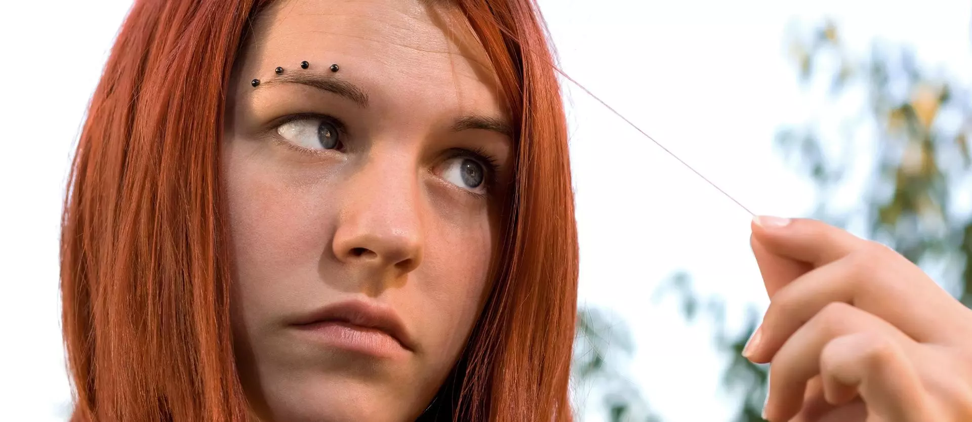 What is Trichotillomania? What is Trichotillomania?