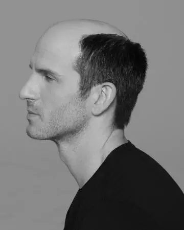 01 mens hair replacement virtual reality 02 solutions photo gallery mens hair loss american hairlines virtual reality 01 mens hair replacement virtual reality 02