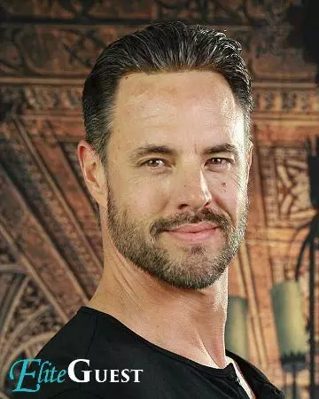 04 mens hair replacement virtual reality 01 solutions photo gallery mens hair loss american hairlines virtual reality 04 mens hair replacement virtual reality 01