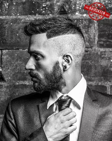 33 hairskeen mens european hair replacement 01 solutions photo gallery mens hair loss hairskeen 33 hairskeen mens european hair replacement 01