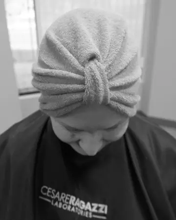   solutions photo gallery womens hair loss crlab 13 womens thinning hair loss system restoration european crlab cnc 02