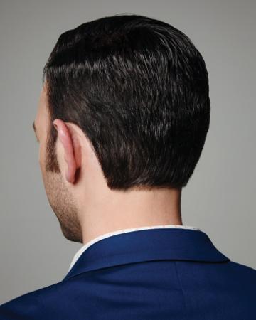 13 mens hair replacement virtual reality 01 solutions photo gallery mens hair loss american hairlines virtual reality 13 mens hair replacement virtual reality 01