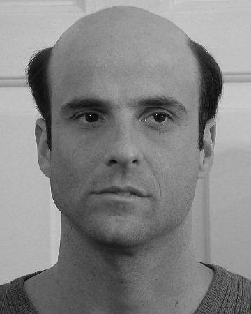 20 mens hair replacement virtual reality 02 solutions photo gallery mens hair loss american hairlines virtual reality 20 mens hair replacement virtual reality 02